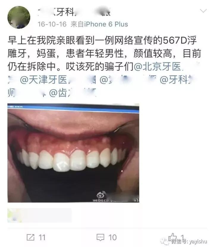 纳米炫齿浮雕反馈微博