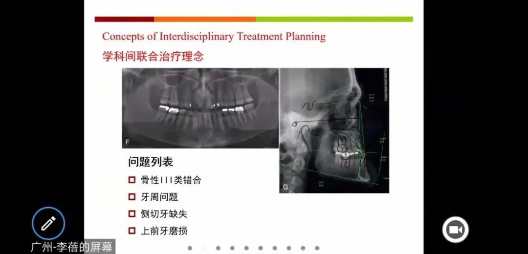 尊龙凯时阳光口腔举行正畸医生分享会